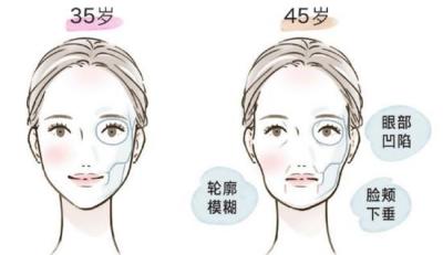 眼周问题根源大起底！眼部的进阶版护理指南